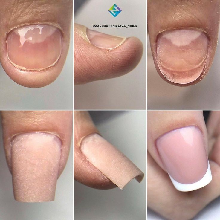 Наращивание 1 ногтия (ремонт 1 ногтя)