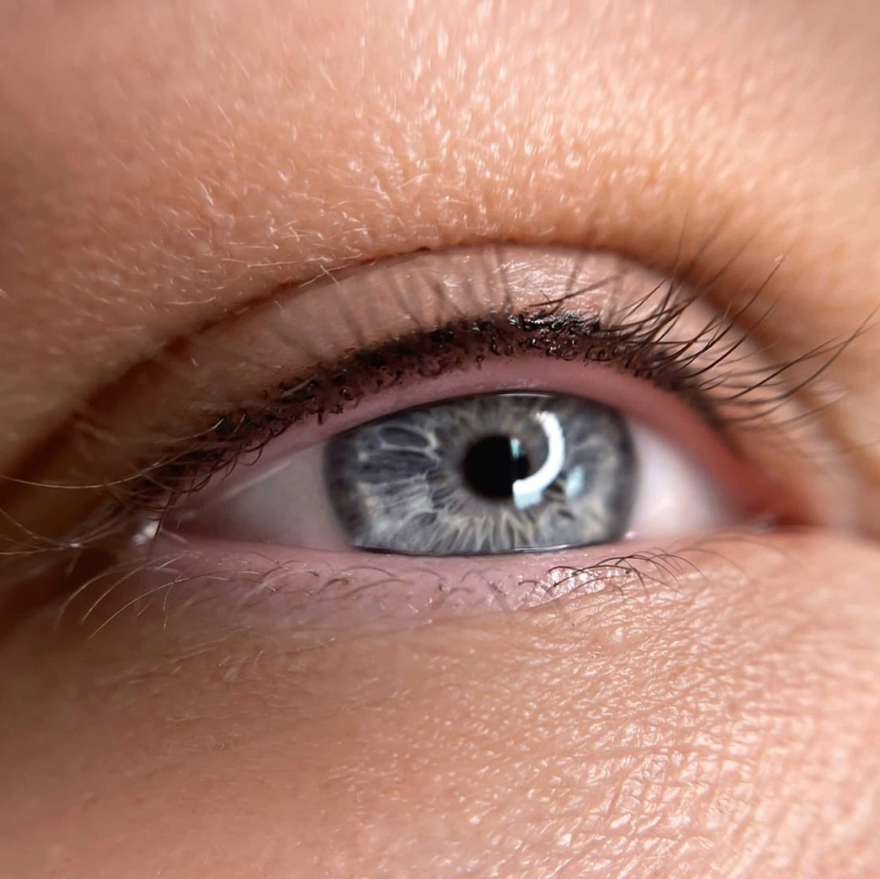 Межресничка