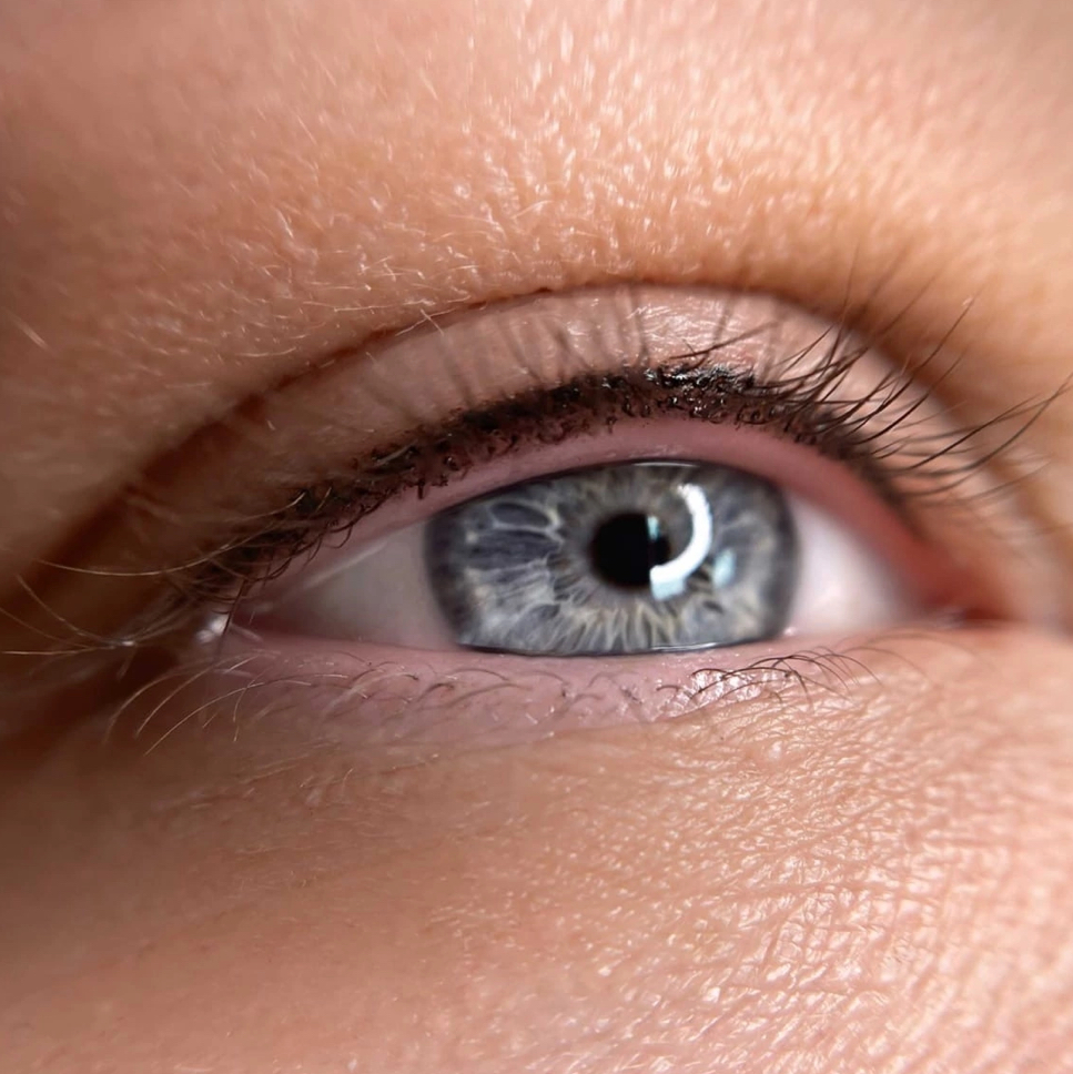 Межресничка обновление цвета до 2,5 лет