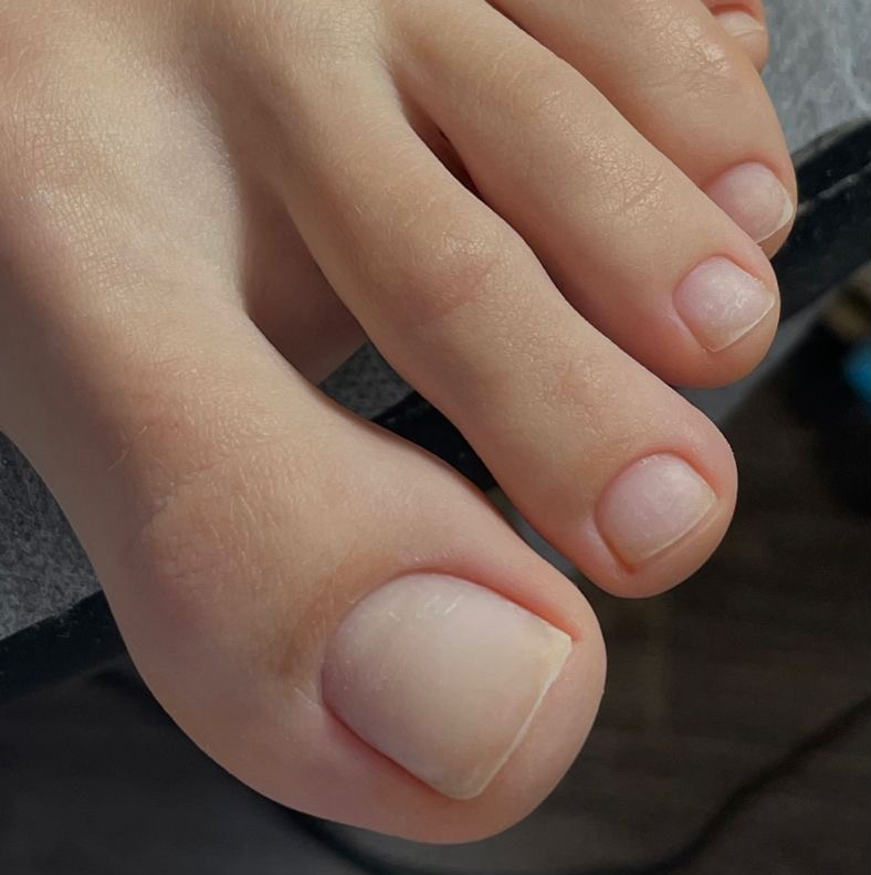 Pedicura / cortar uñas