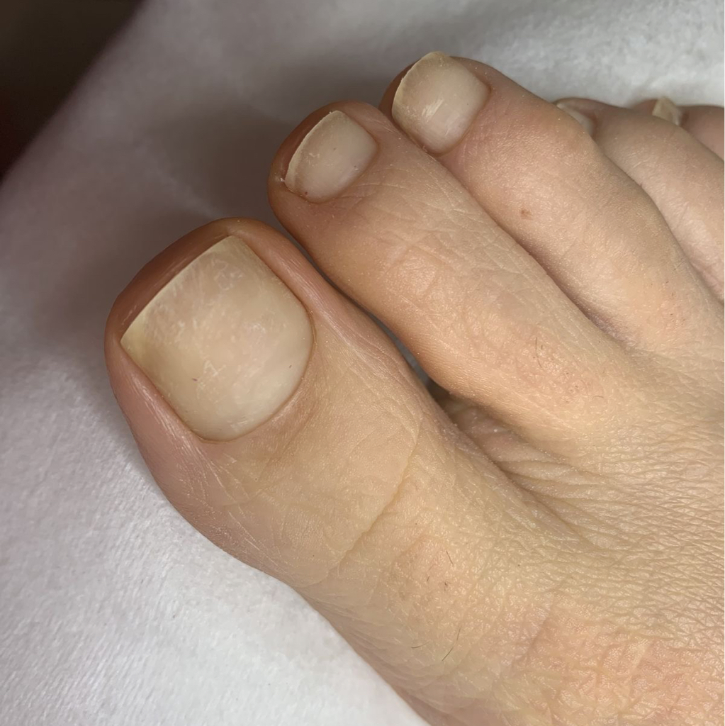 Pedicura completa