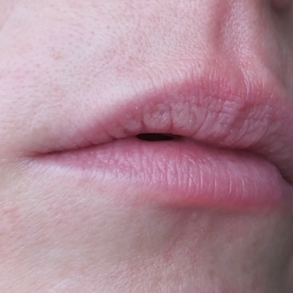 ДЕПИЛЯЦИЯ воском нежелательных волосков на лице (усики, подбородок)