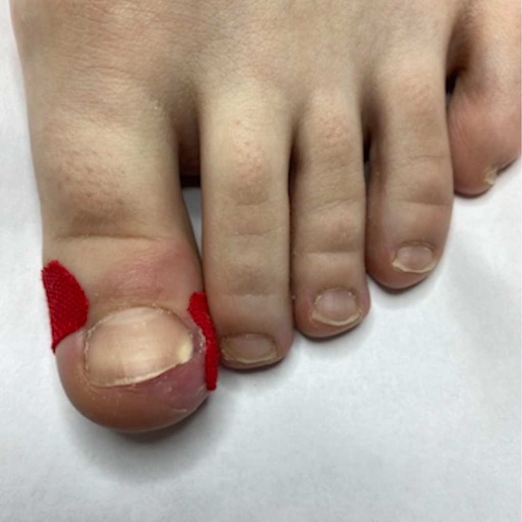 Перевязка (повторное посещение)