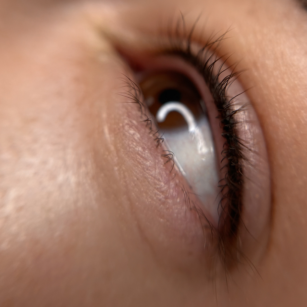 ПМ межресника