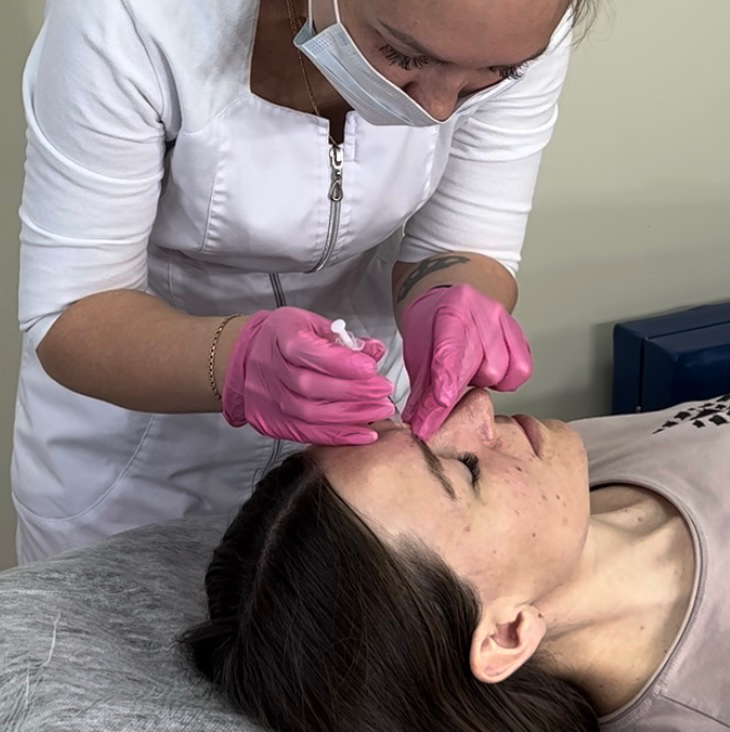 Ботокс 3 зон