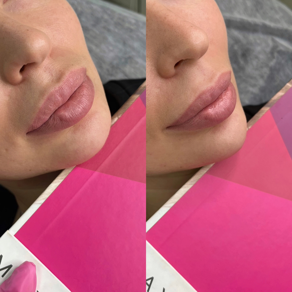 Подбородок