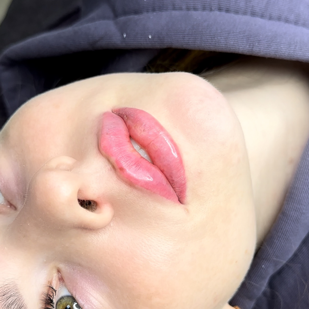 Препарат Хиамакс (Швейцария)