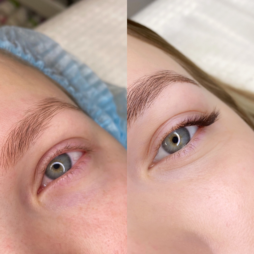 Наращивание уголков