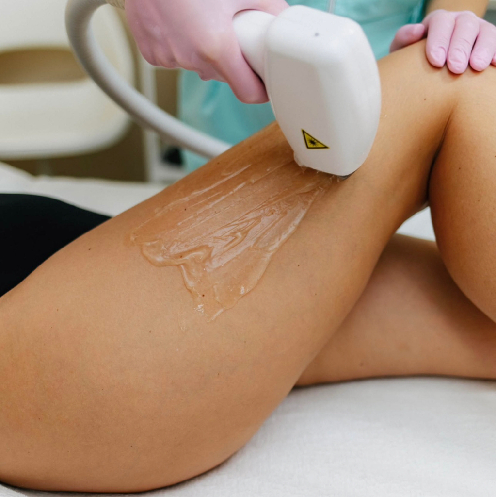 ⚡️ Лазер: Голени/бедра