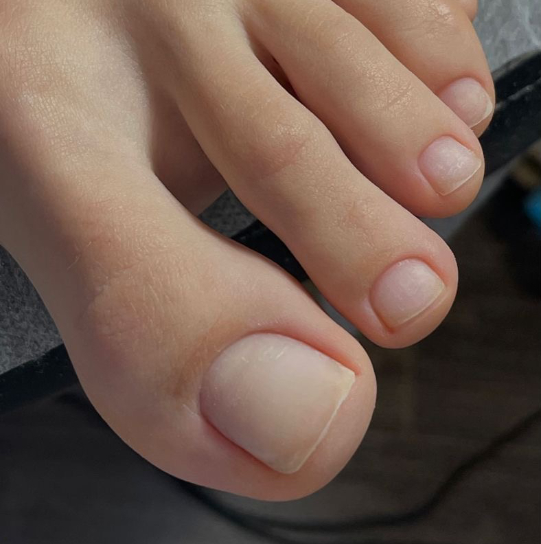 Педикюр  (обработка пальчиков)  без покрытия