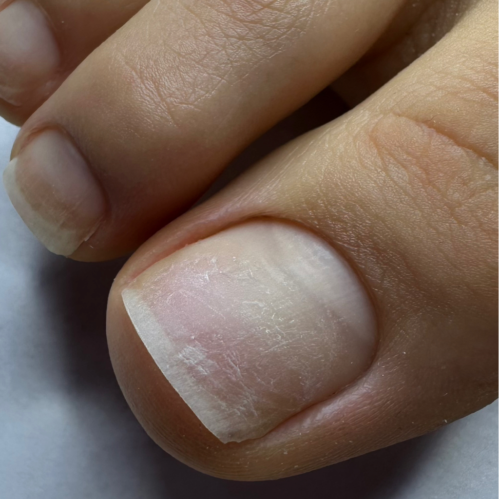 Обработка пальчиков без покрытия