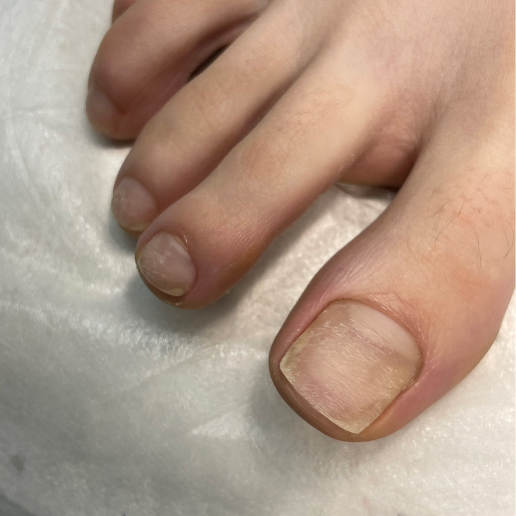 Педикюр без покрытия (обработка стопы и пальцев)