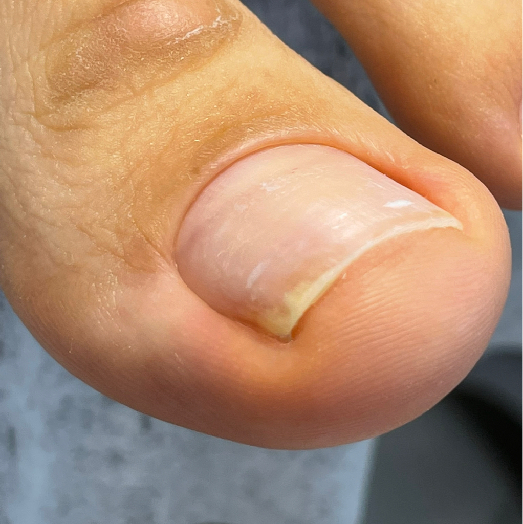 Обработка пальцев ног  без покрытия