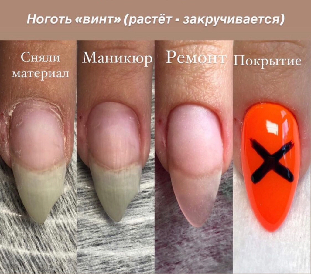 Ремонт 1 ногтя