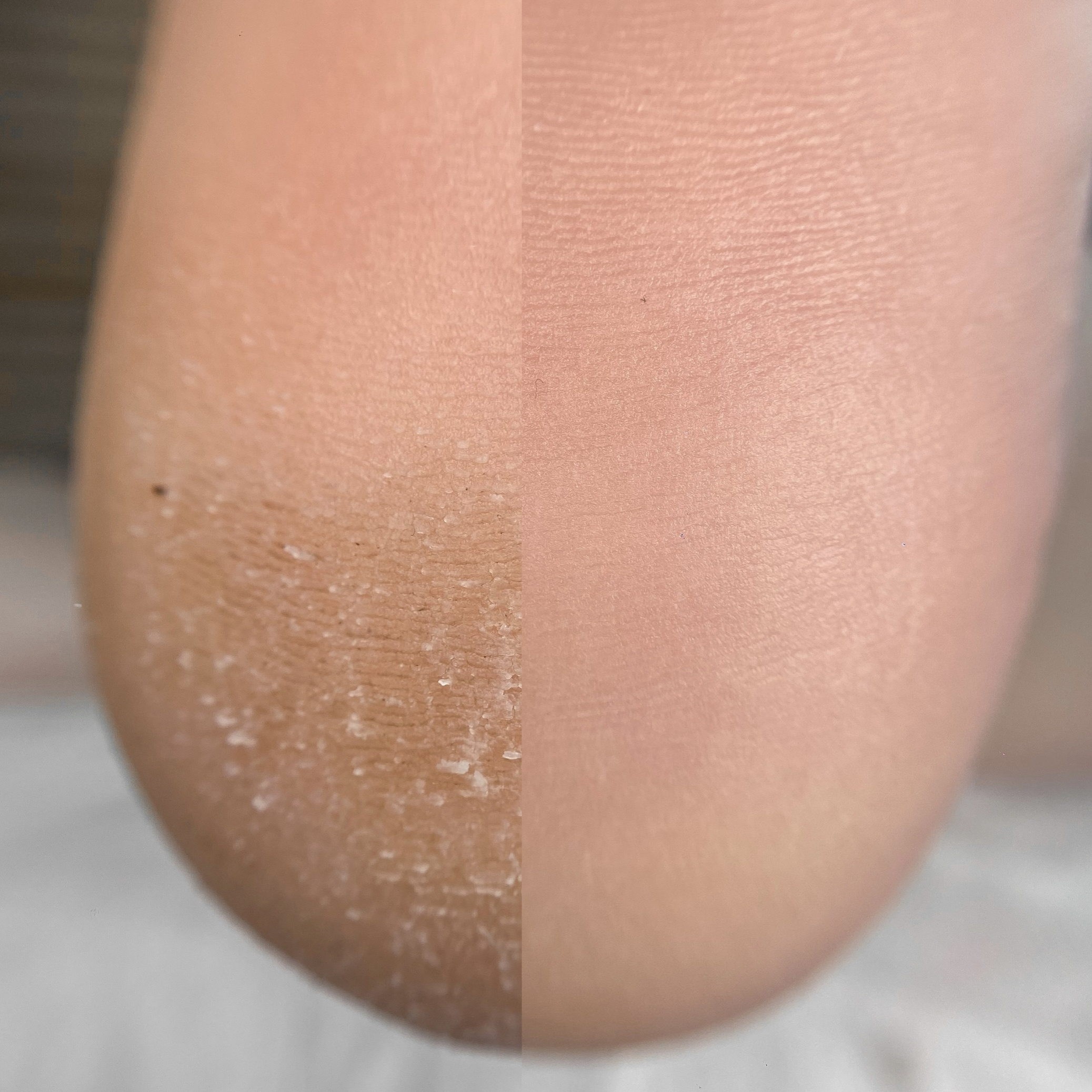 BASE | педикюр Golden Trace без покрытия с пяточкой