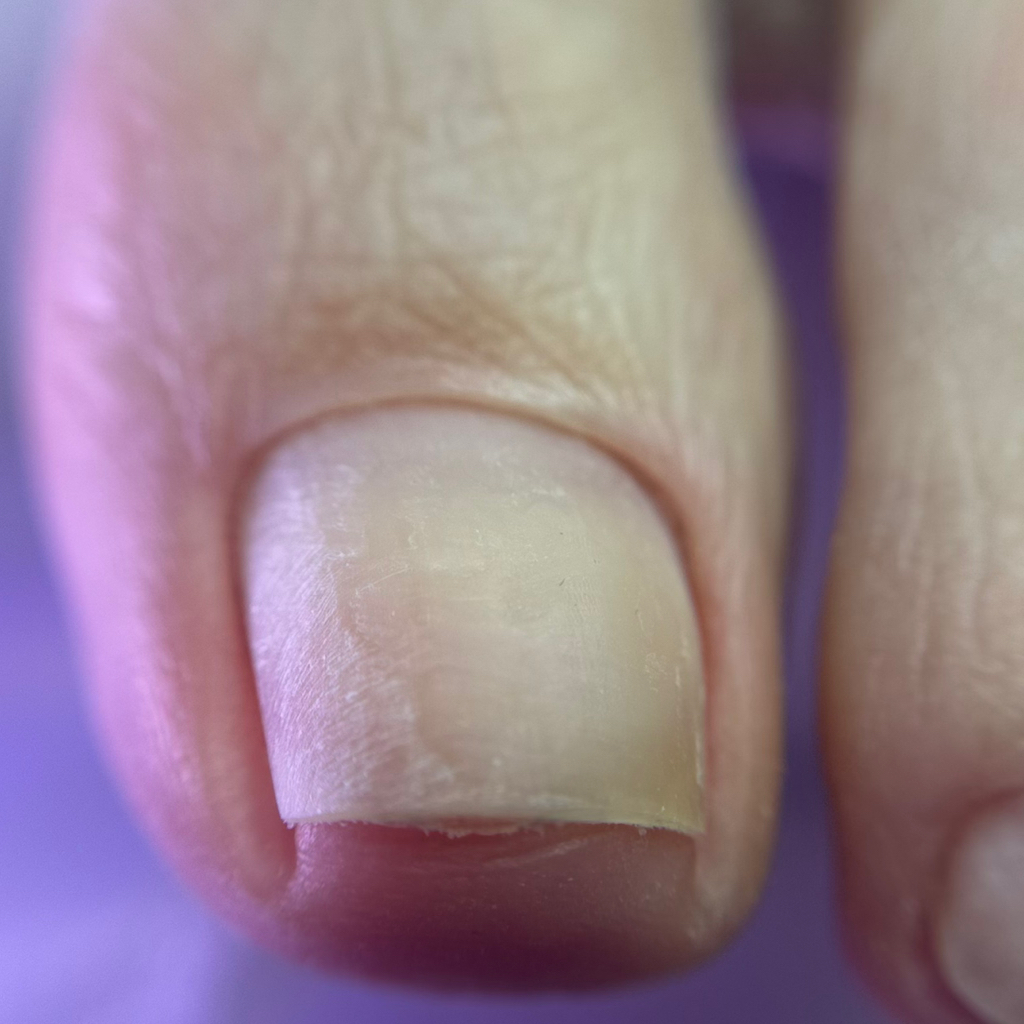 Педикюр (обработка стопы и пальчиков, без покрытия)