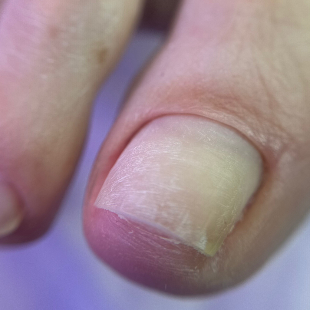 Педикюр обработка пальчиков