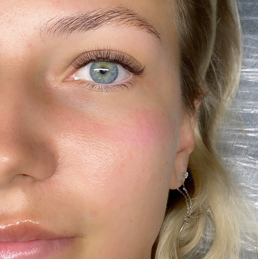 Классическое наращивание