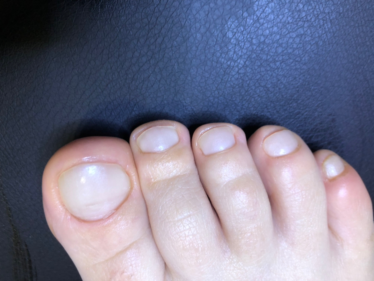 Педикюр (только пальчики без покрытия или лак)