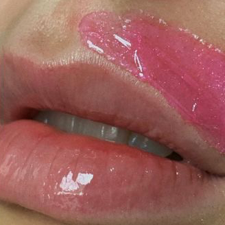 Тридинг (удаление волос с лица)