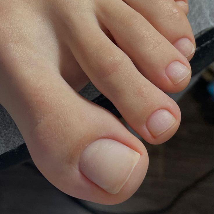 Педикюр (пальчики)|Pediküre (zehen)