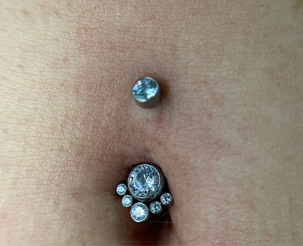 Прокол пупка