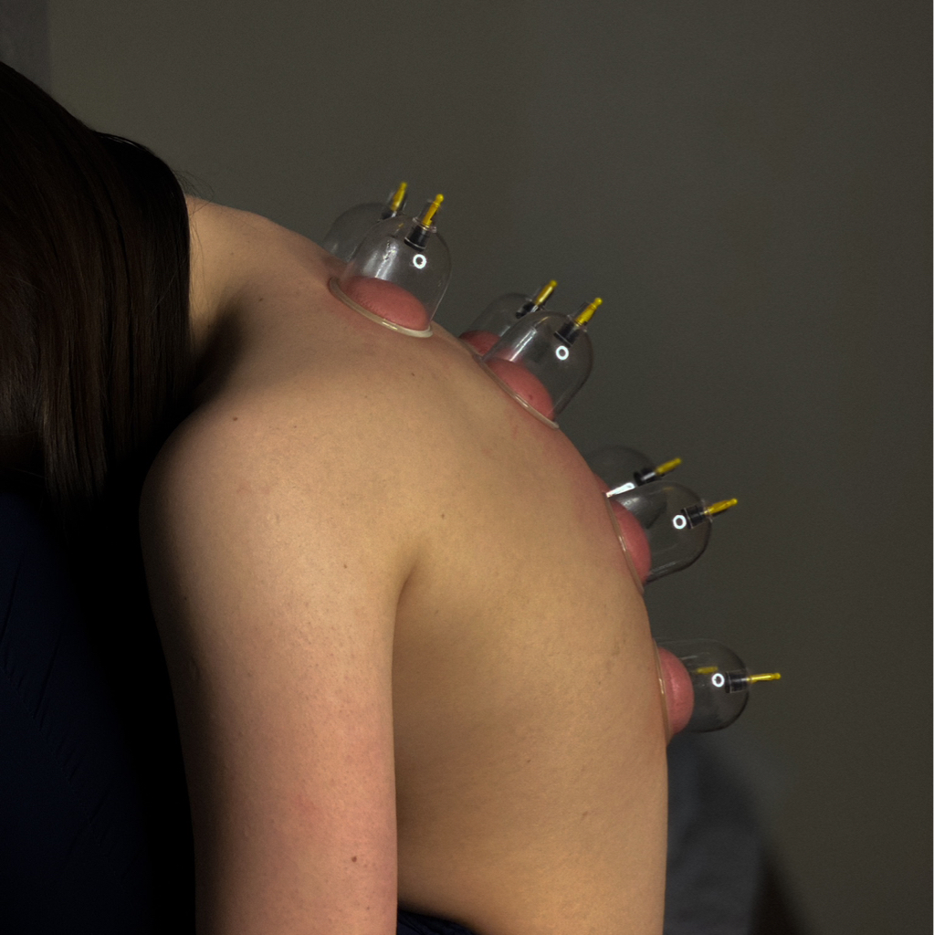 Вакуумные банки