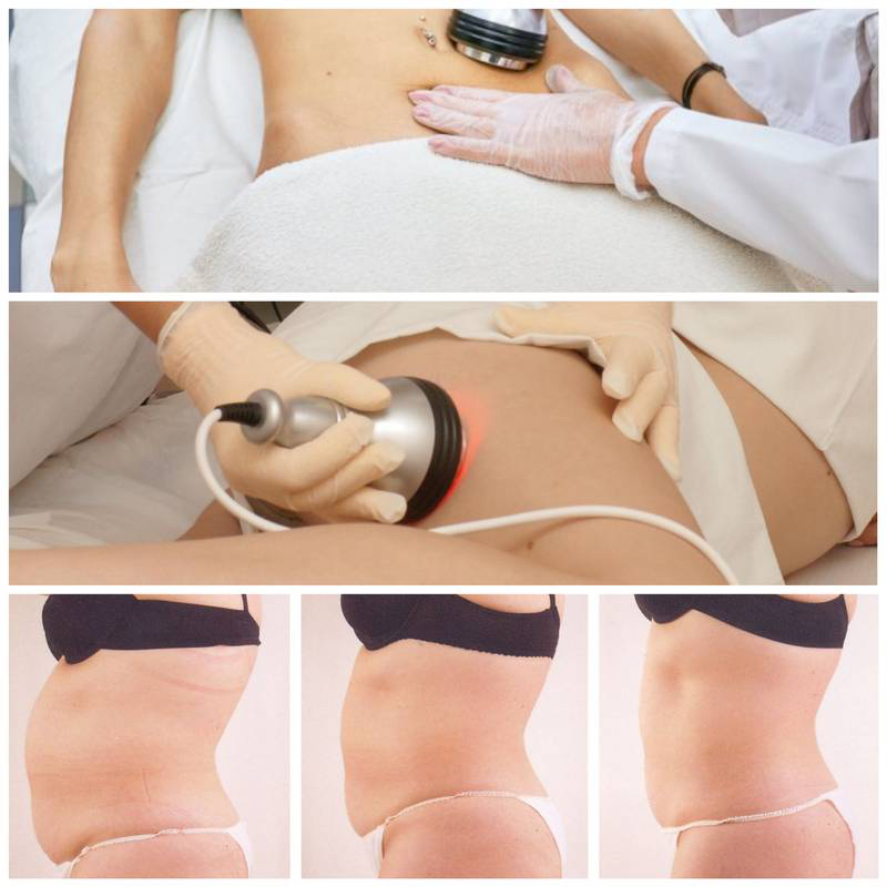 Комбо (кавитация+ турбо вибрация) -1 зона