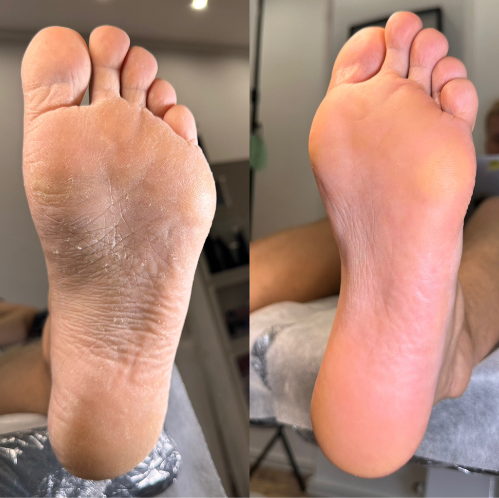 Мужской аппаратный педикюр - Pedicura de pedicura con hardware para hombres