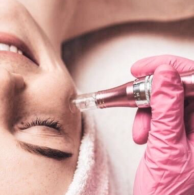Фракционная мезотерапия
