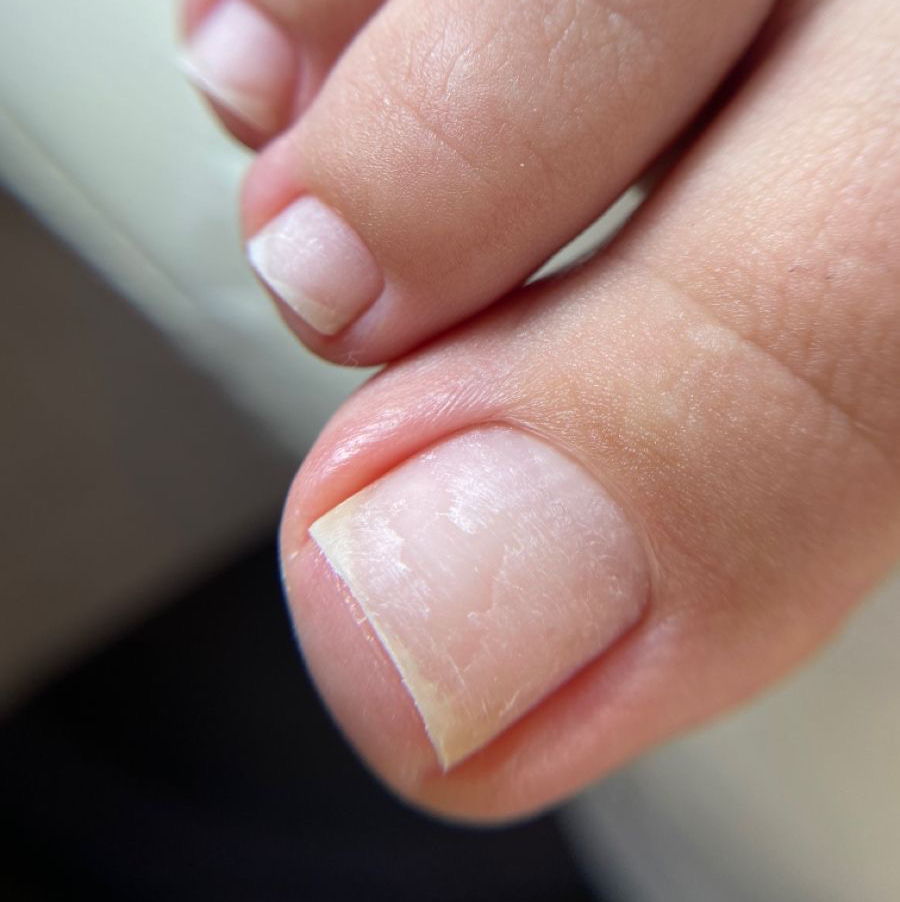 Снятие + пальчики