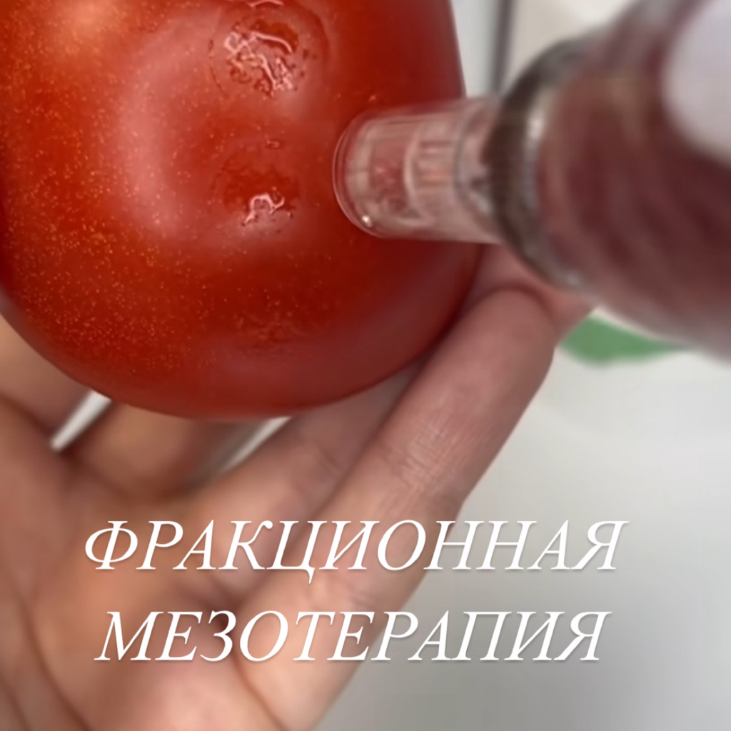 Фракционная мезотерапия