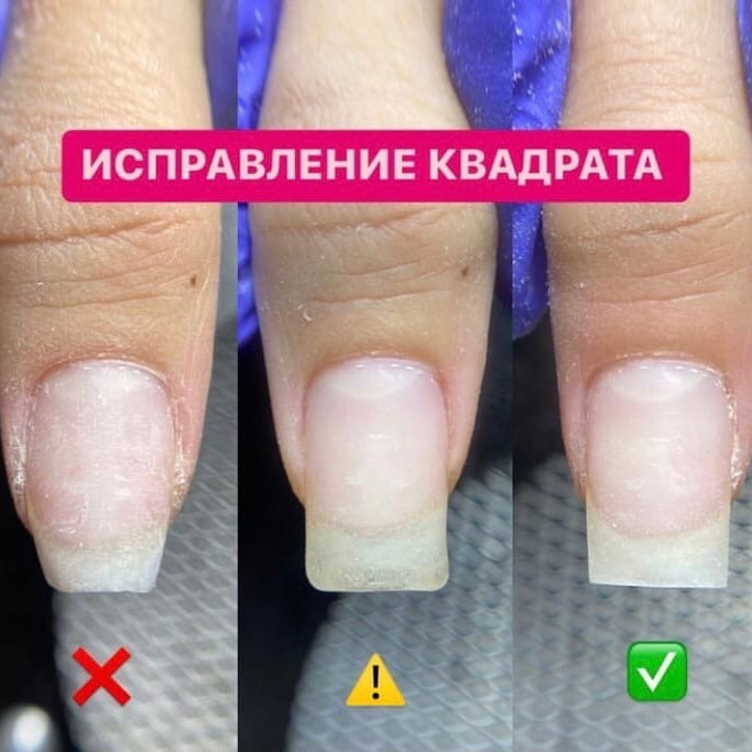 укрепление, восстановление архитектуры.