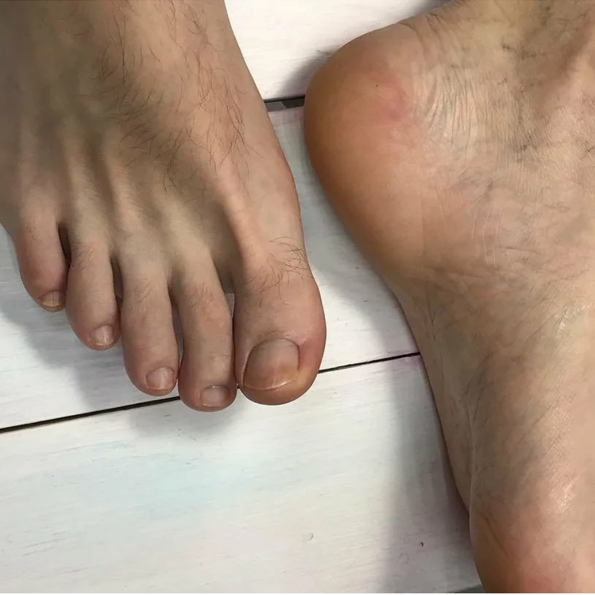 Мужской педикюр