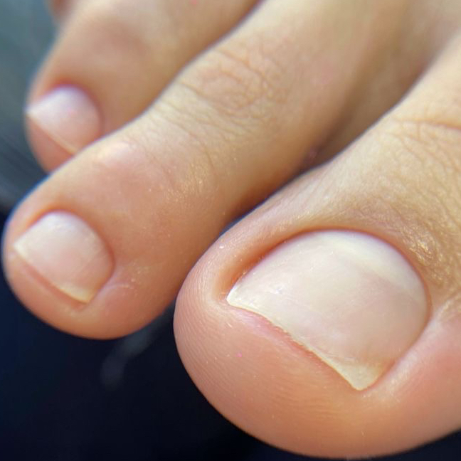 Педикюр (обработка пальчиков без покрытия )