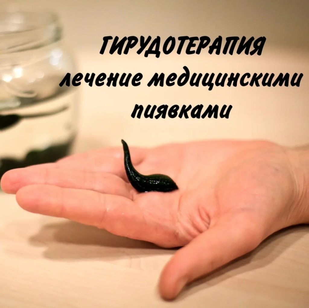 Медицинская пиявка