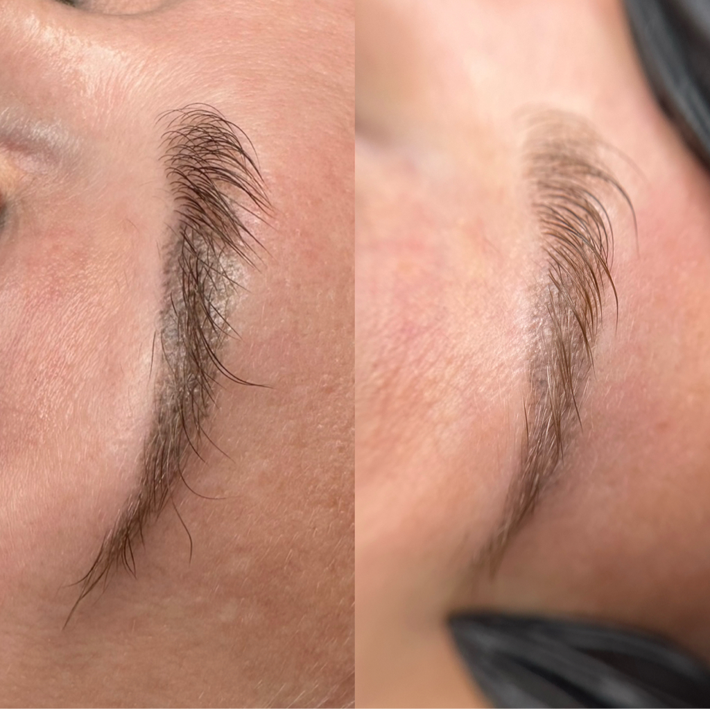 Удаление ремувером