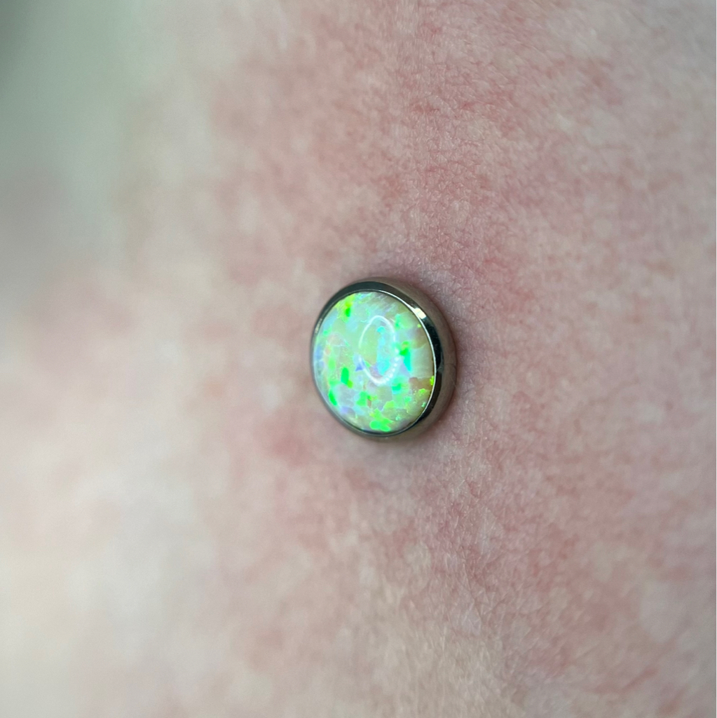 Замена микродермала