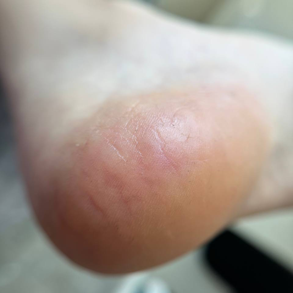 Педикюр( только полная обработка стоп )