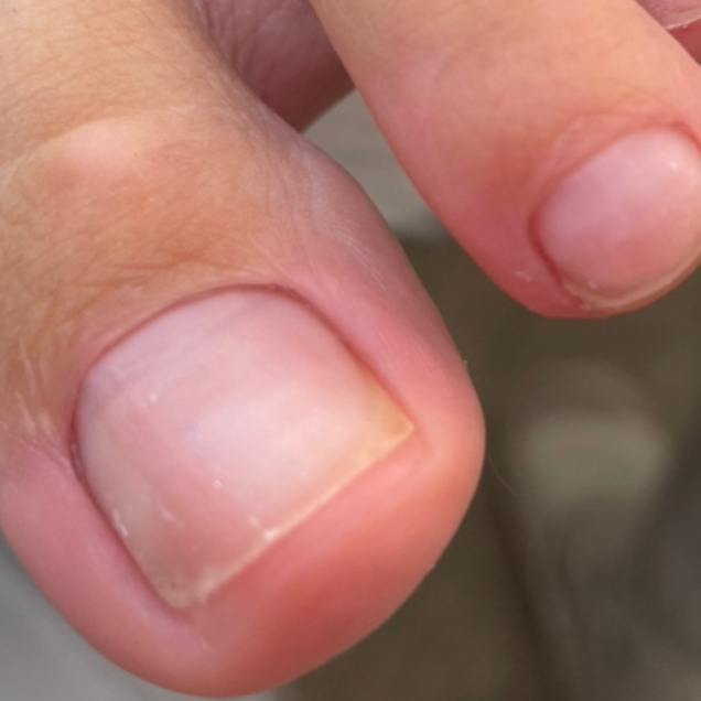 Гигиенический педикюр пальчиков