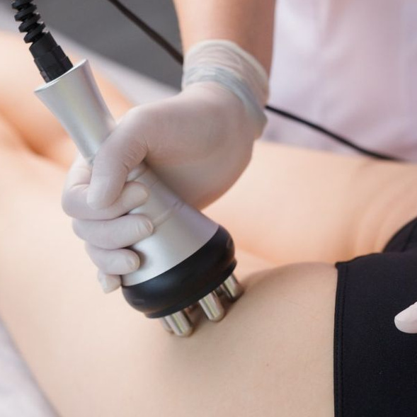 RF лифтинг тела /5 процедур/