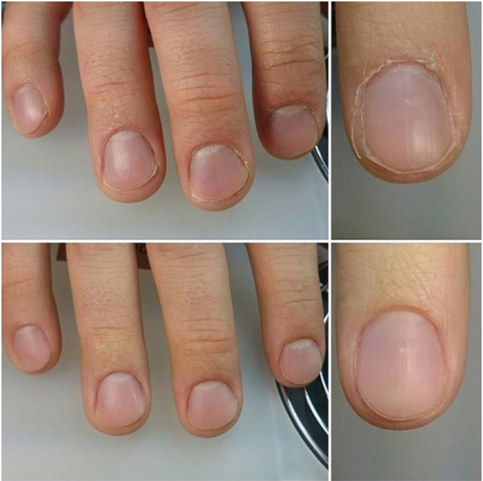 Маникюр комбинированный