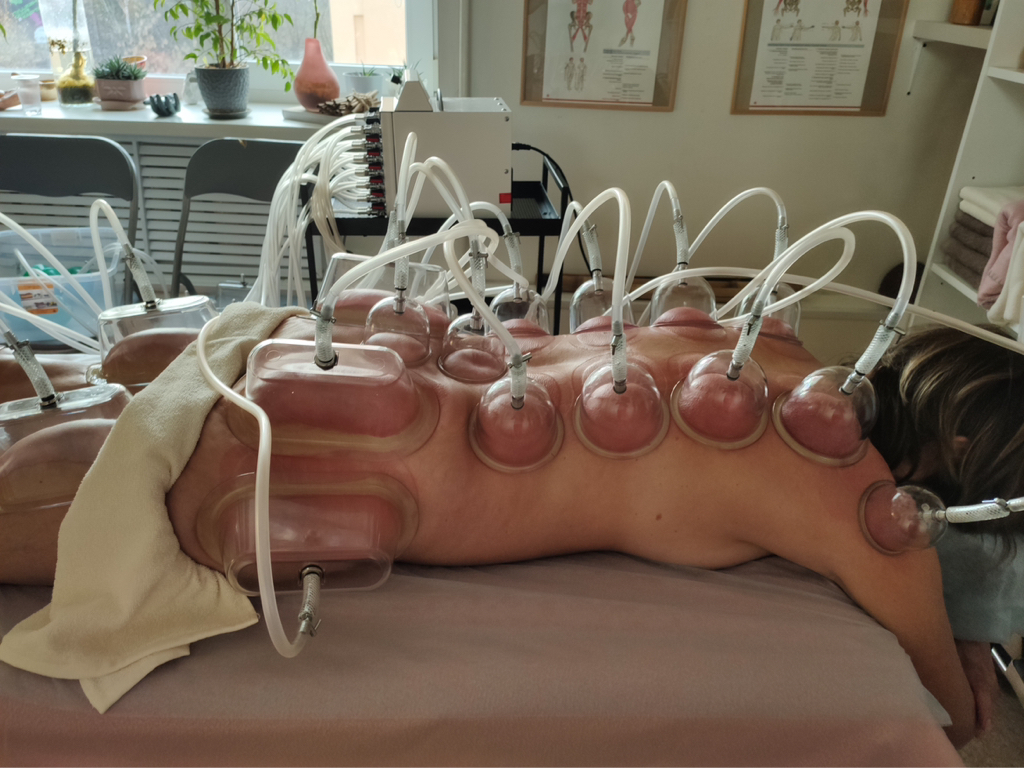 Вакуум-градиентная терапия: спина, ягодицы, ноги (50 мин)