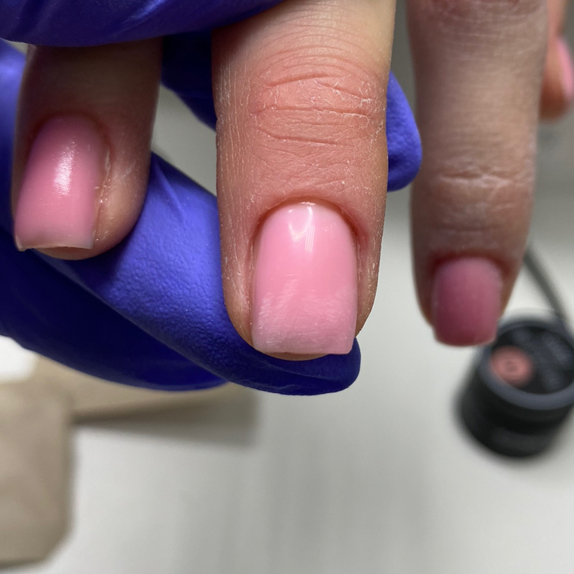 Ремонт ногтя