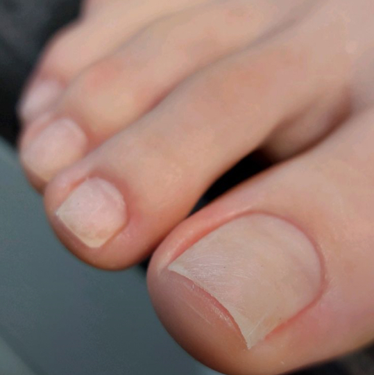 Педикюр пальцы без покрытия