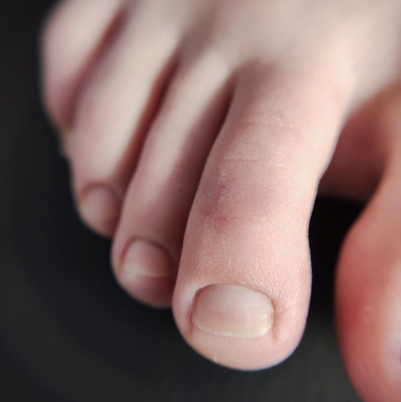 Педикюр мужской (полная обработка)