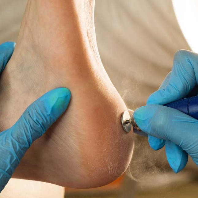 Педикюр стопа