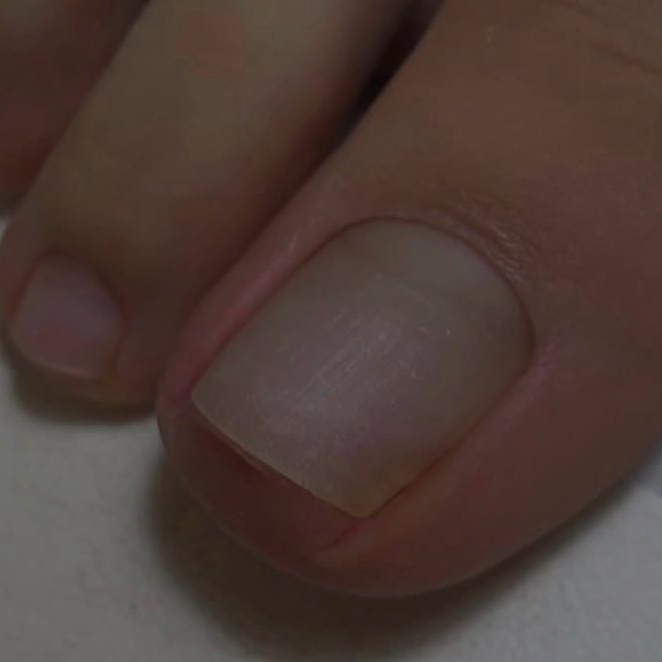 Педикюр без покрытия + стопы