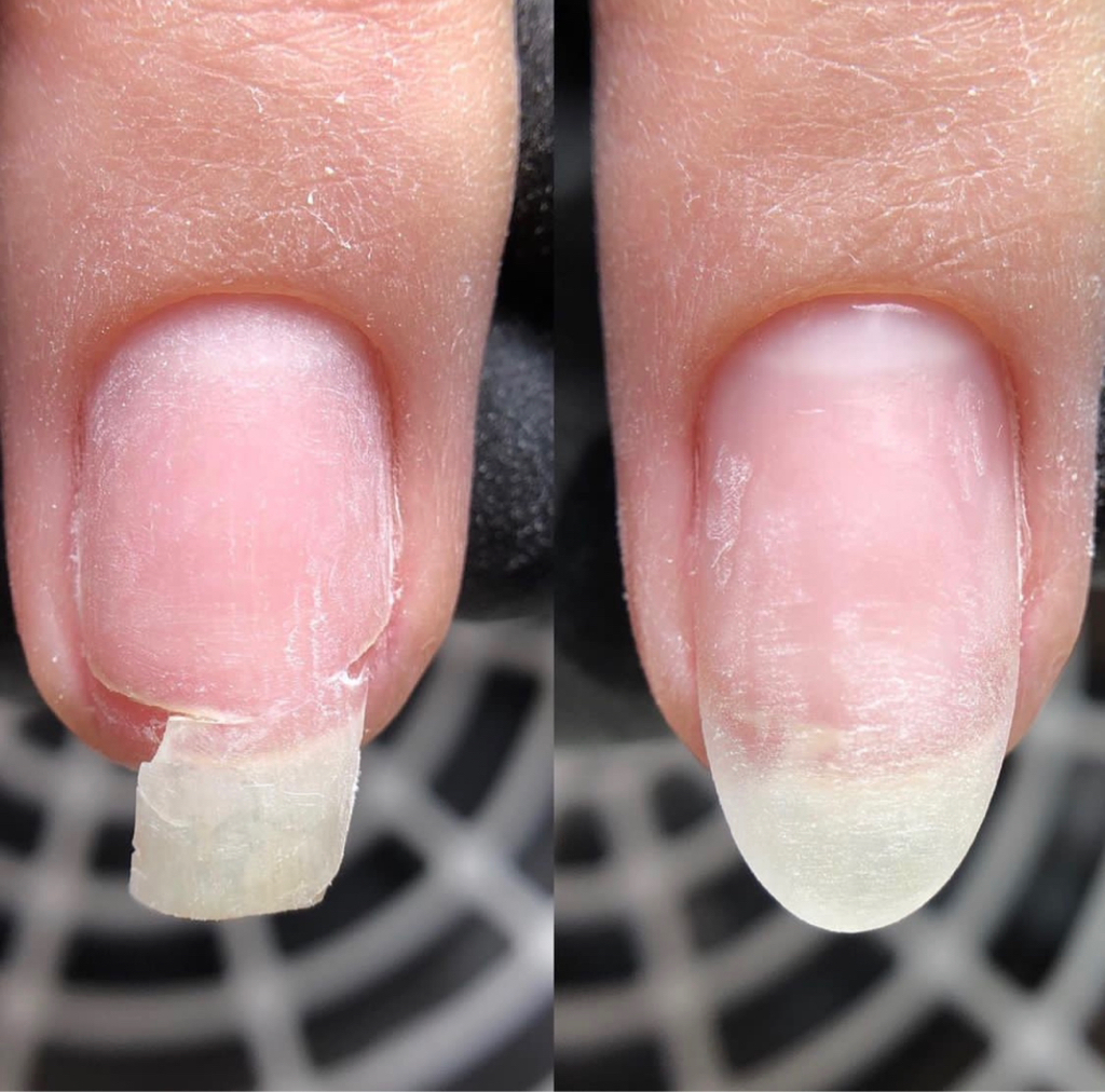 Наращивание одного ногтя