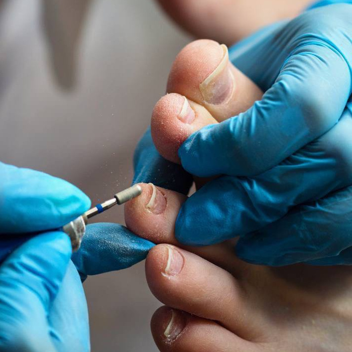 Обработка пальчиков